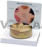 Skin Cancer Model